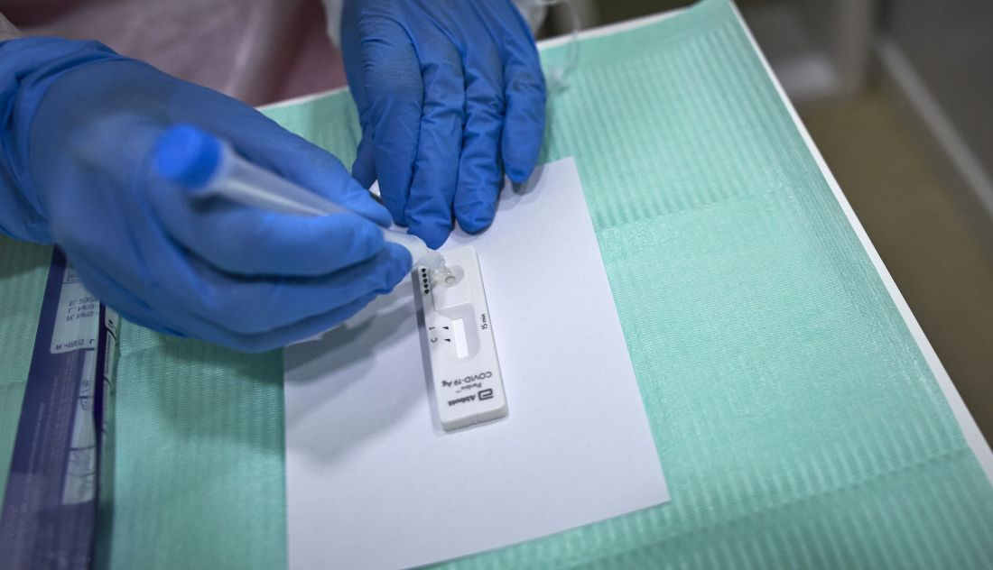 Los Test De Antígenos Podrán Comprarse En Las Farmacias Sin Necesidad